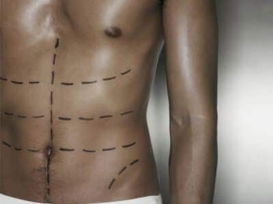 Cuerpo masculino